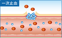 一次止血