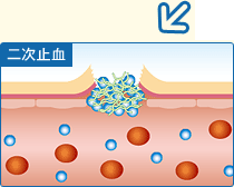 二次止血